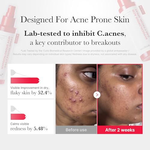 AHA + BHA Exfoliating Body Cleanser – Skin Smoothing & Refreshing Body Care